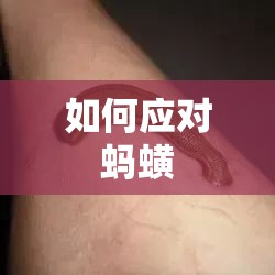 如何应对蚂蟥
