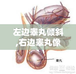 左边睾丸倾斜,右边睾丸像是立着是怎么回事-