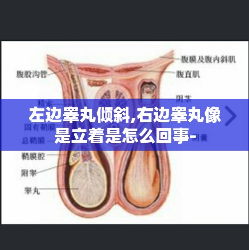 左边睾丸倾斜,右边睾丸像是立着是怎么回事-